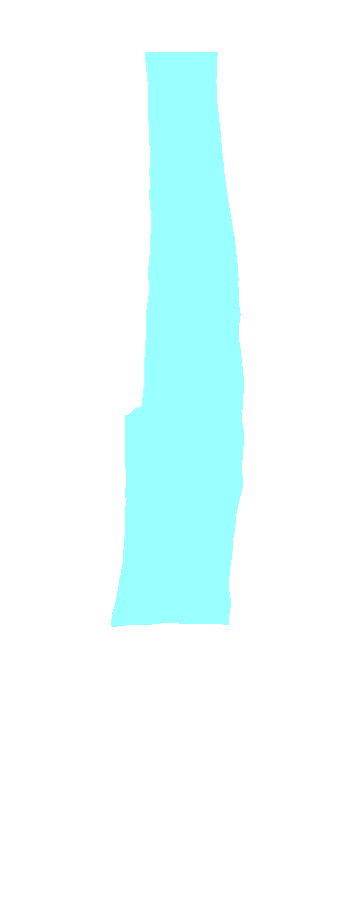 Anterior Surface
