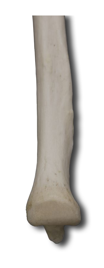Anterior Distal Ulna