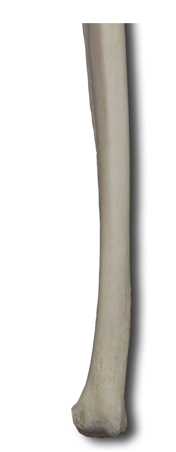Posterior Distal Ulna