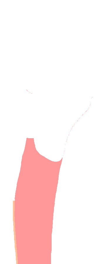 Anterior Surface