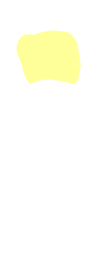 Olecranon Process