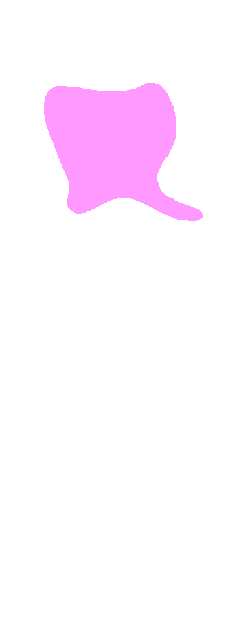 Trochlear Notch