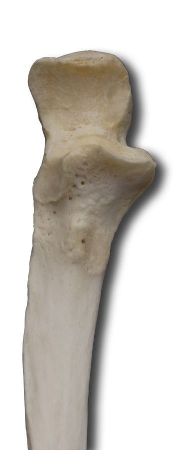 Anterior Proximal Ulna