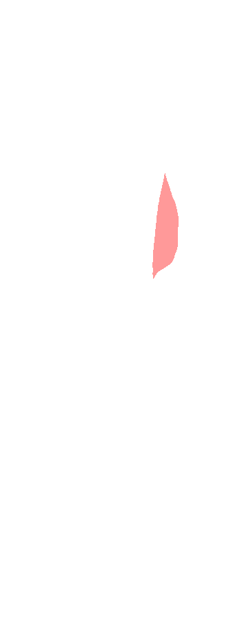 Coronoid Process