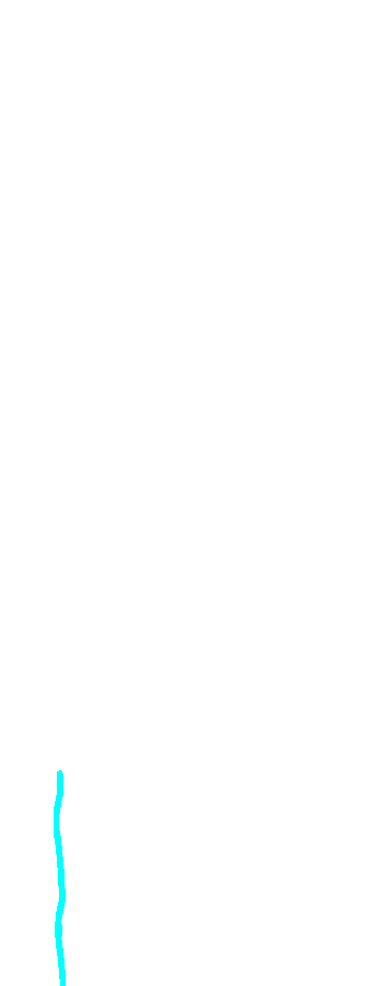 Interosseous Border