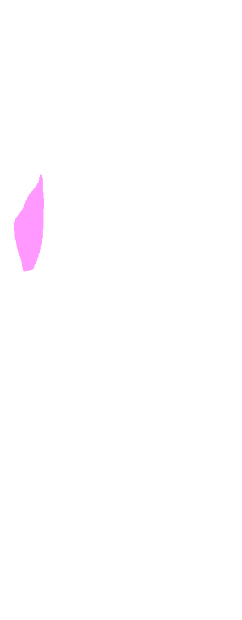 Radial Notch