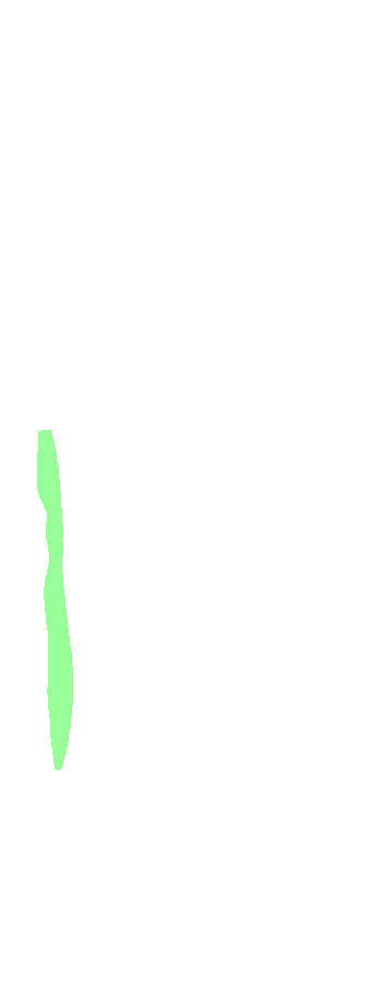 Supinator Crest