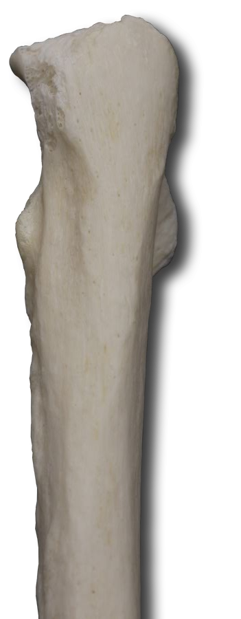 Posterior Proximal Ulna