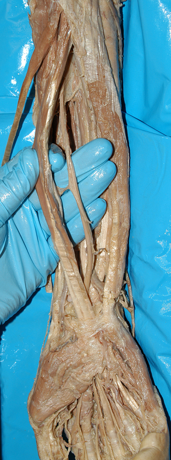 Median Nerve