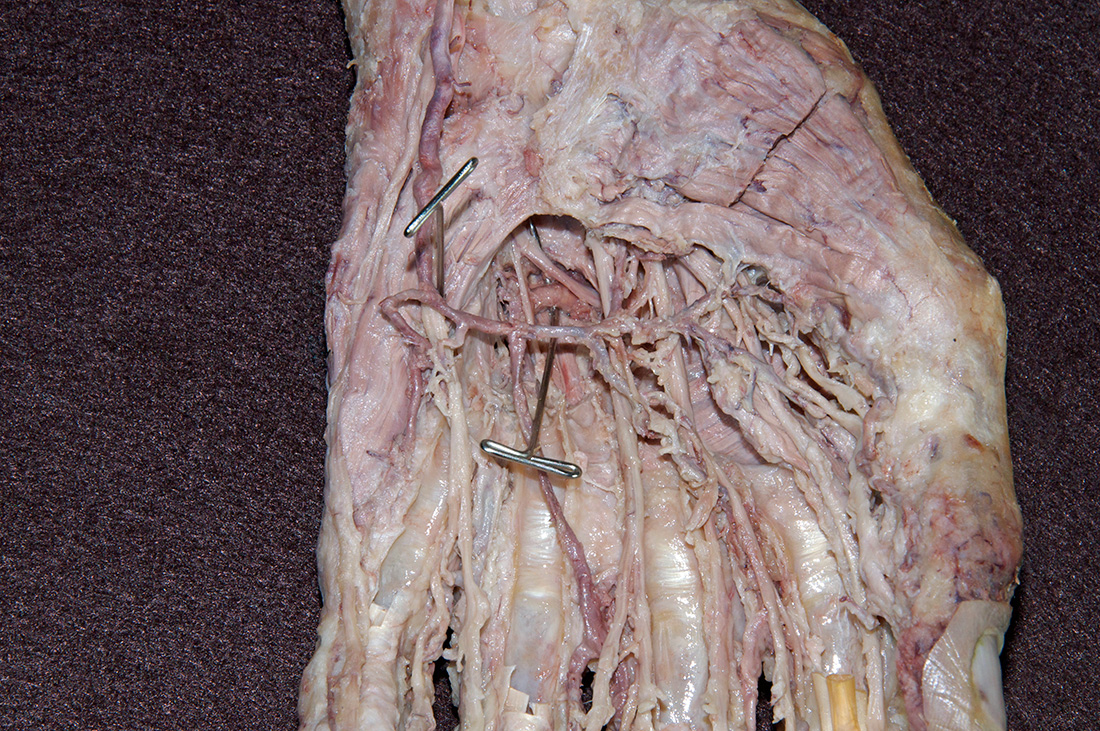 Deep Branch of Ulnar Nerve