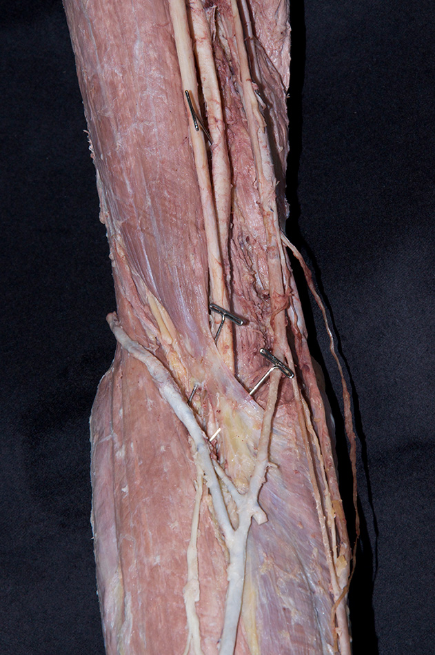 Bicipital Aponeurosis