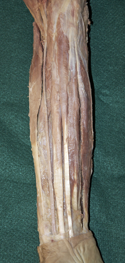 Superficial Forearm Flexors