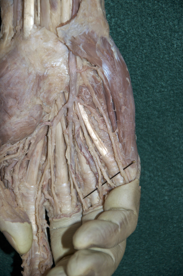 Hypothenar Muscles