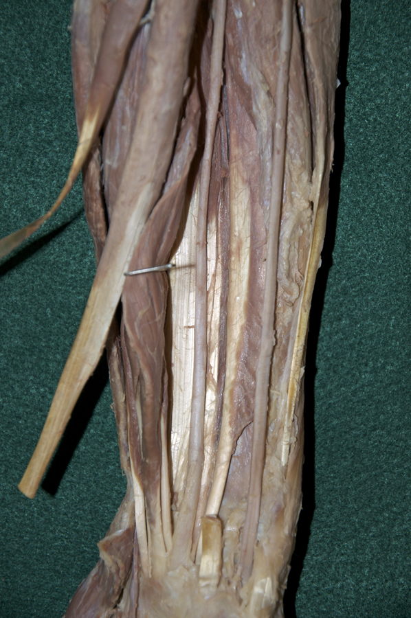 Flexor Digitorum Profundus Muscle