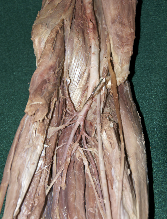 Ulnar Recurrent Arteries