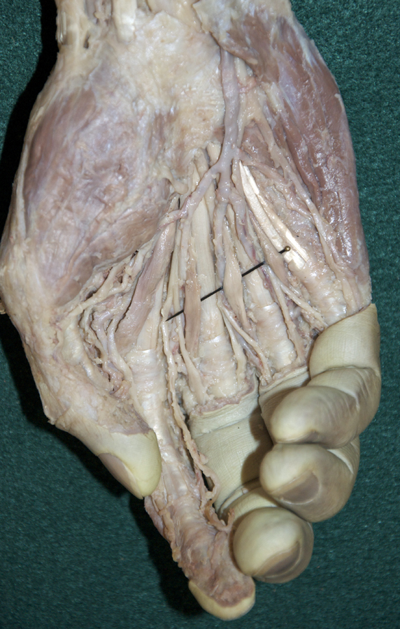Lumbrical Muscles