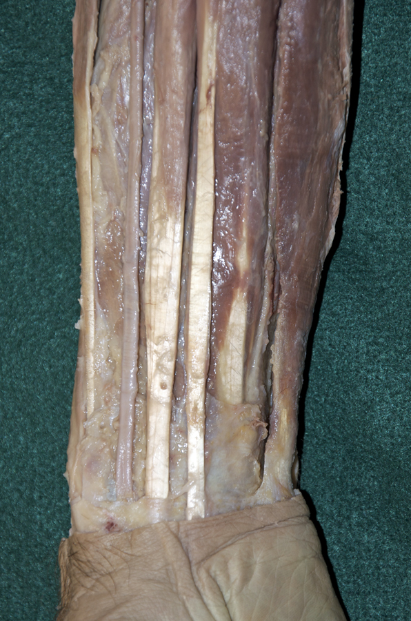 Anterior Wrist