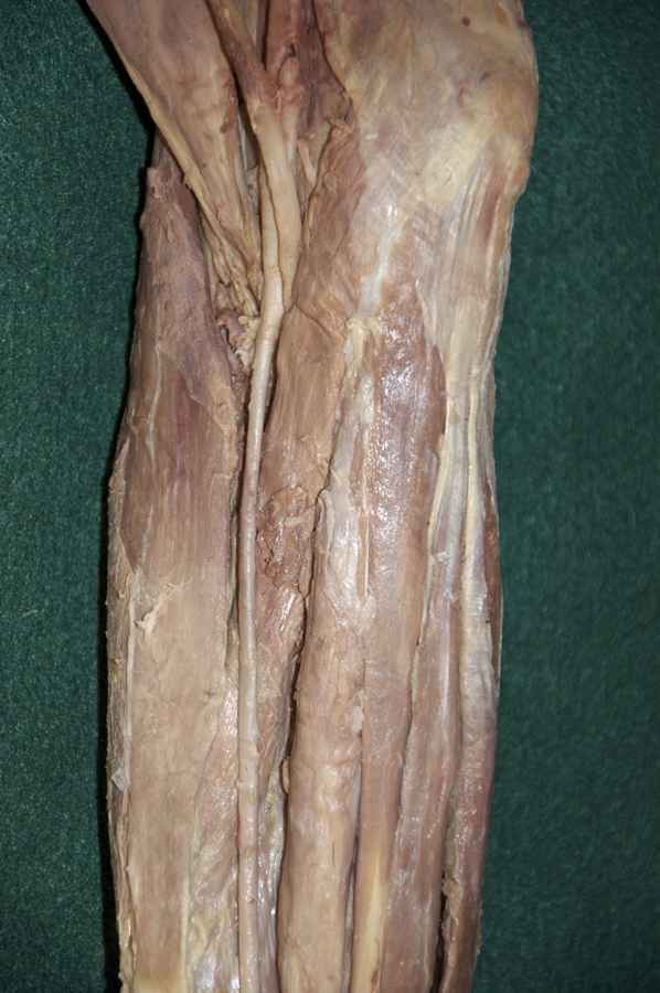 Pronator Teres Muscle