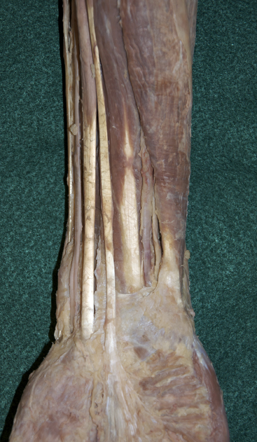 Ulnar Nerve and Artery