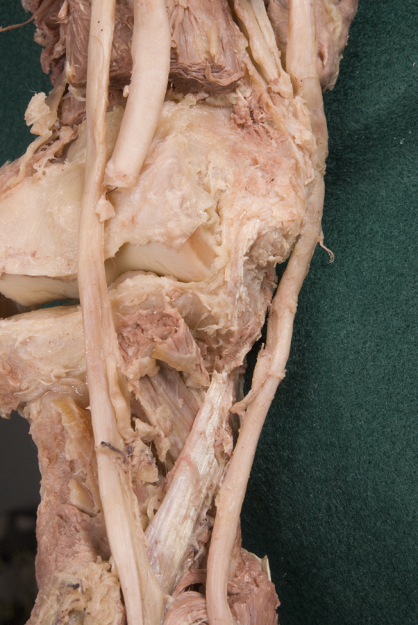 Ulnar Collateral Ligament