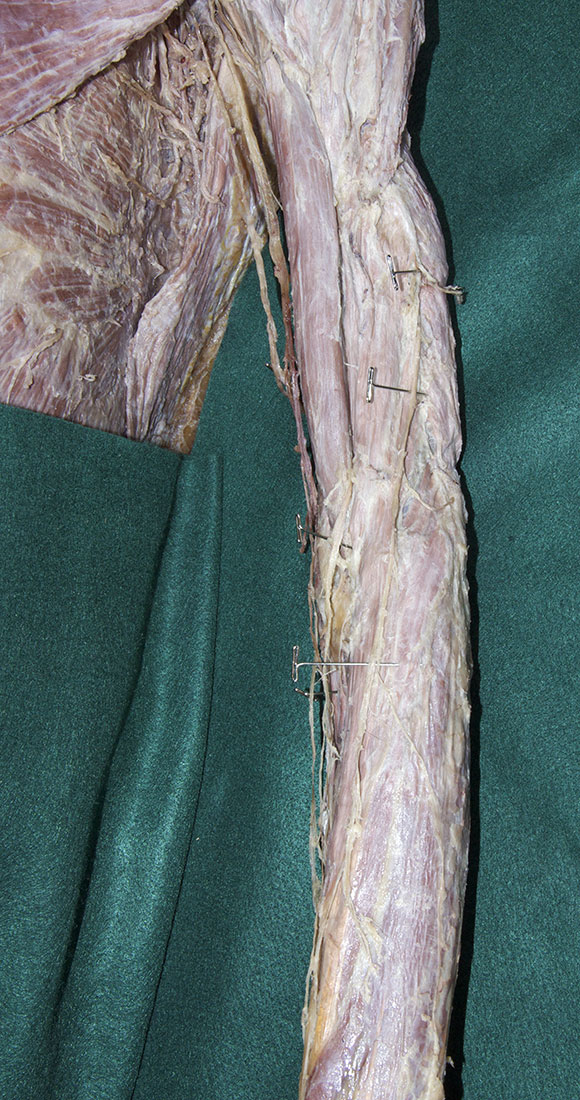 Cutaneous Nerves of the Arm and Forearm