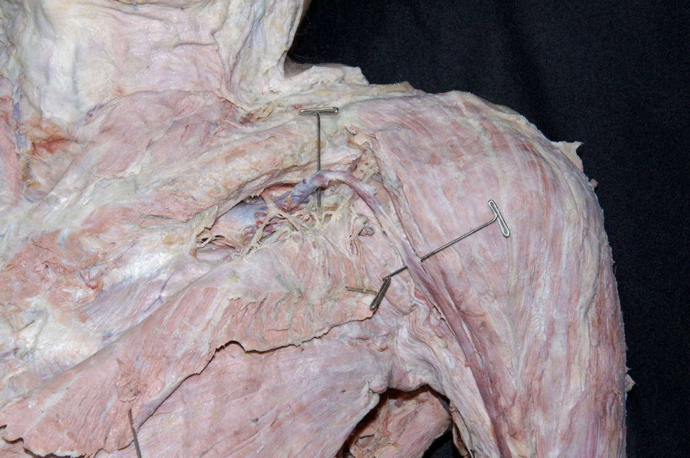 Axillary Vein