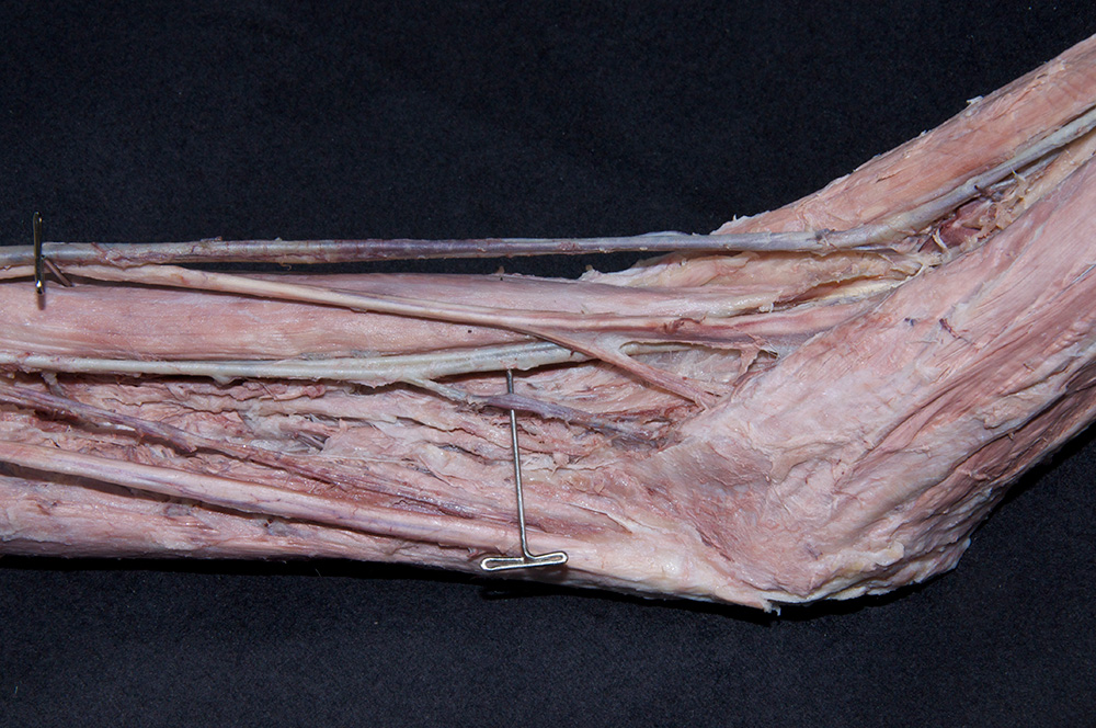 Inferior Ulnar Collateral Artery