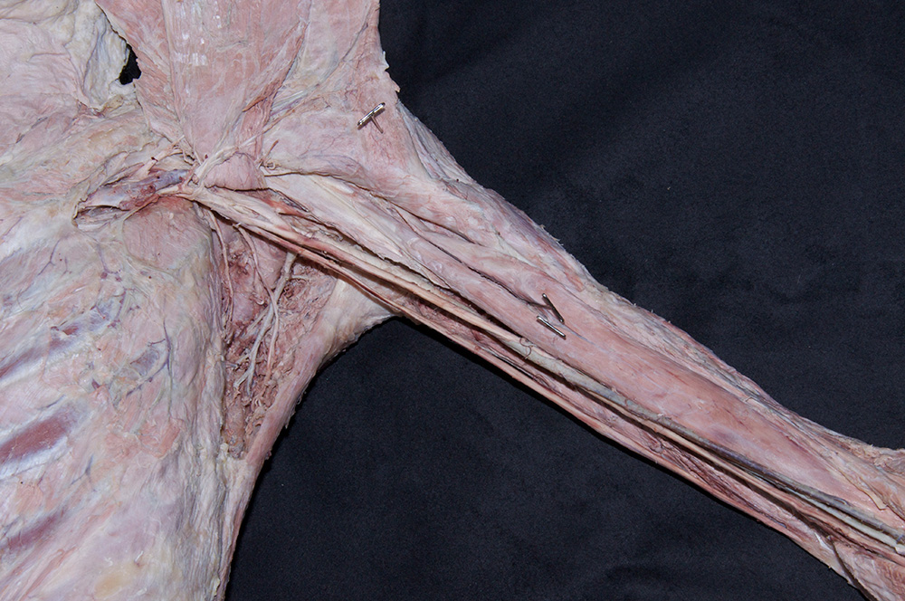 Biceps Brachii Muscle