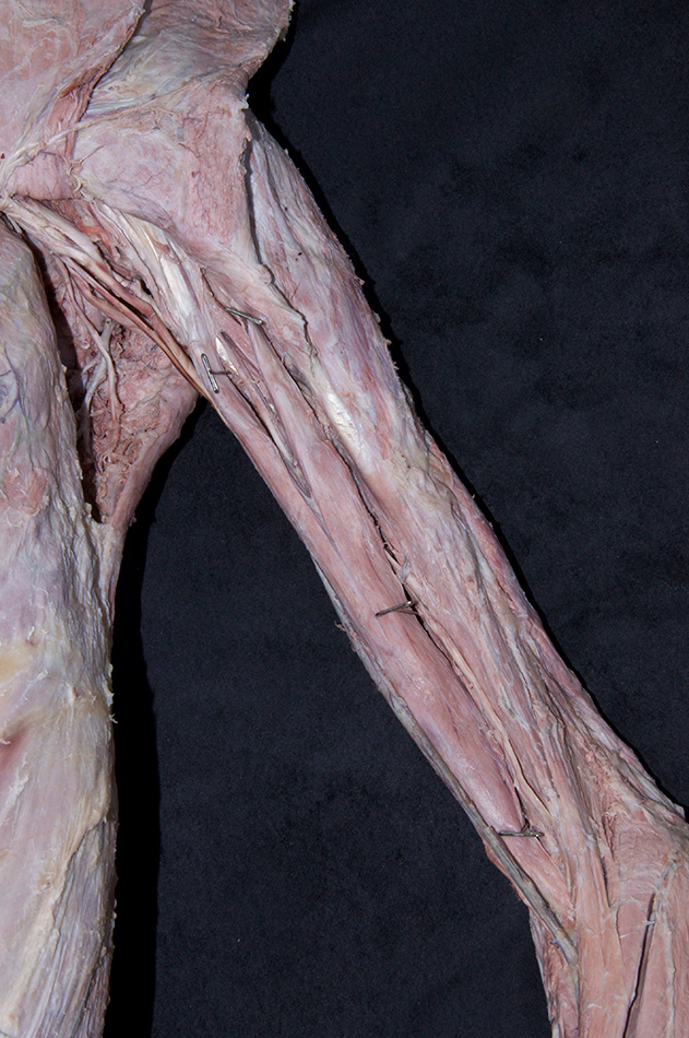 Brachialis Muscle