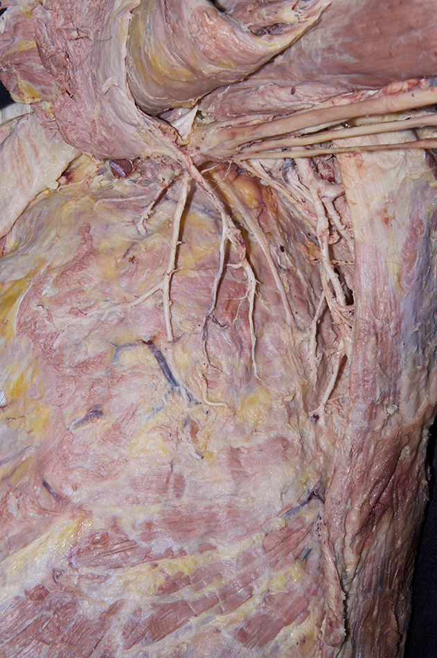 Lateral Thoracic Artery