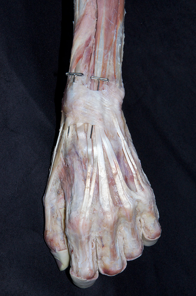 Extensor Retinaculum
