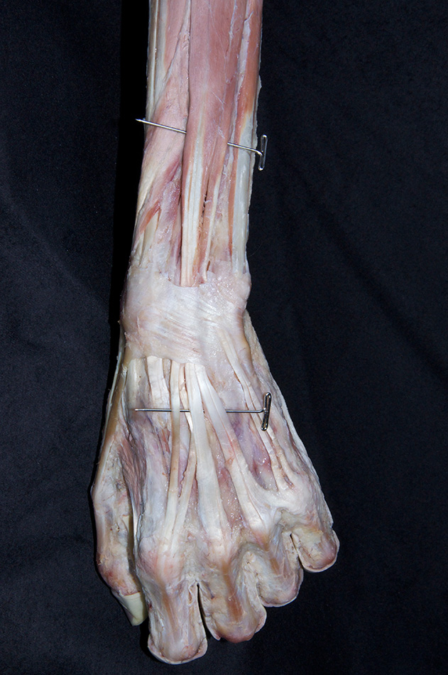Extensor Digitorum Muscle