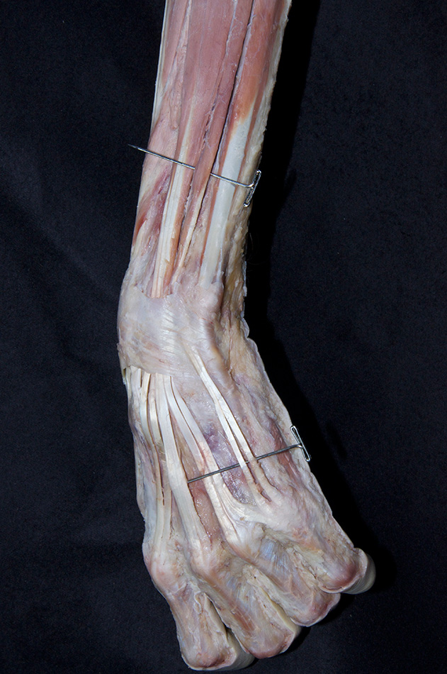 Extensor Digiti Minimi Muscle