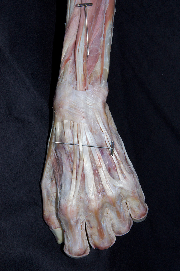 Extensor Indicis Muscle