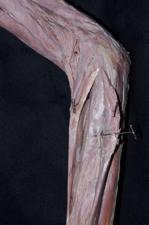 Supinator Muscle