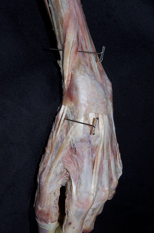 Extensor Pollicis Brevis Muscle