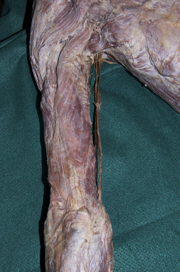 Triceps Muscle