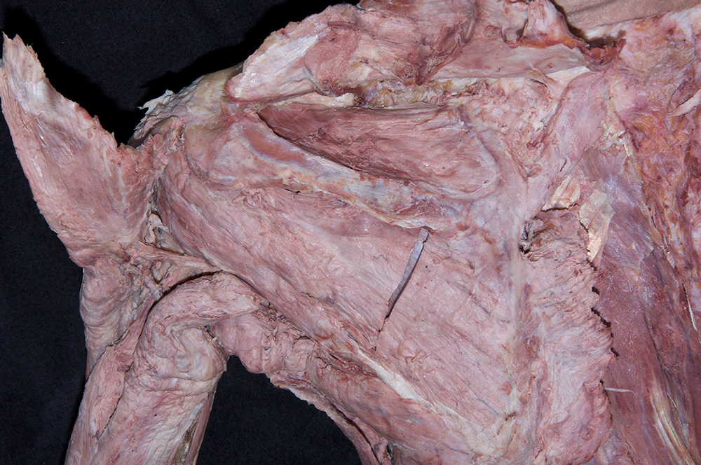 Supraspinatus Muscle