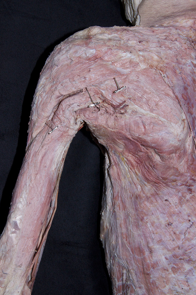 Deltoid Muscle