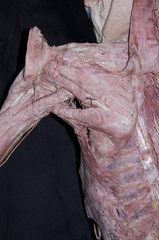 Teres Major Muscle