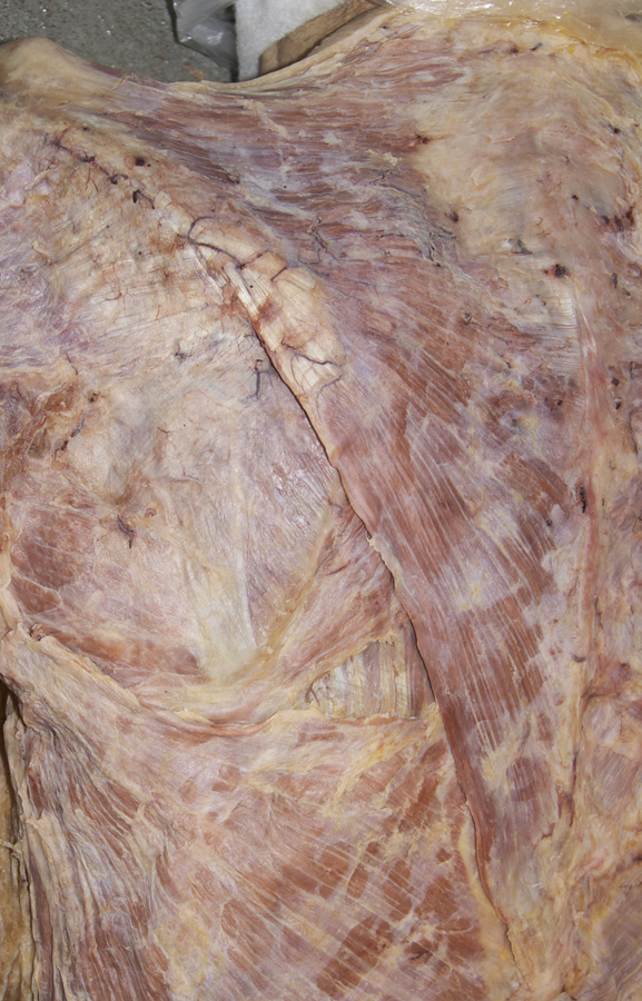 Trapezius Muscle