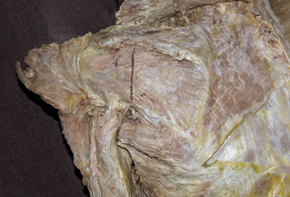 Posterior Shoulder