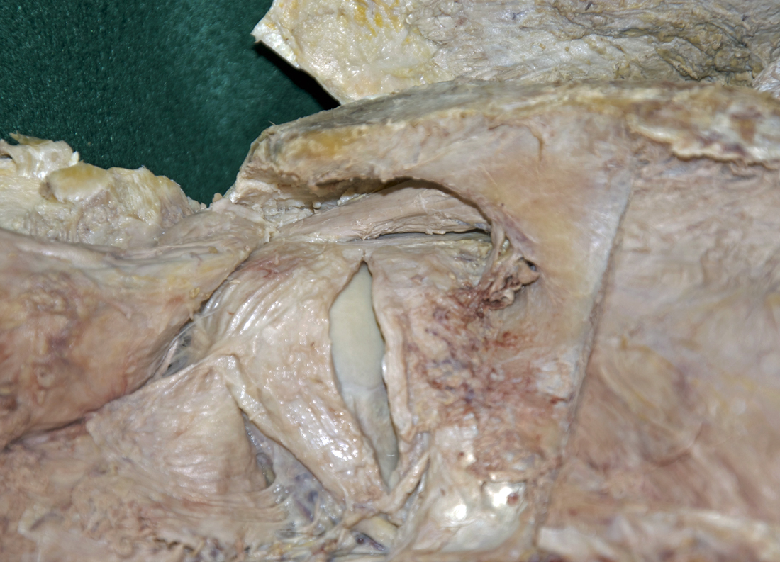 Posterior Joint Capsule