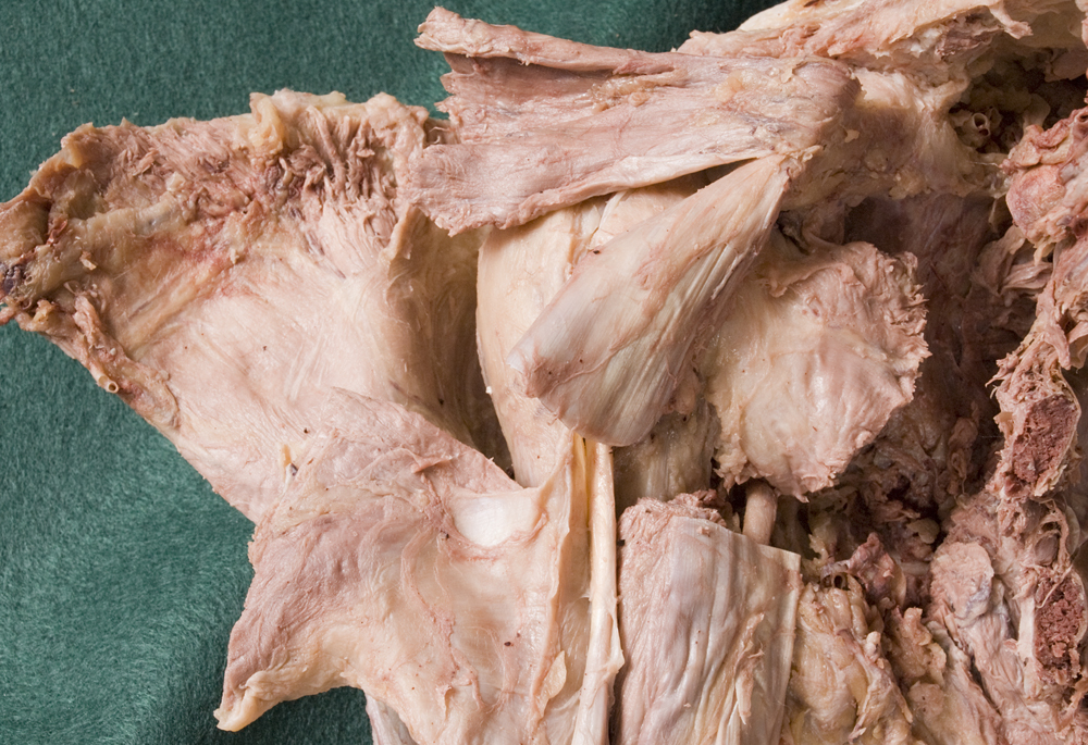 Anterior Shoulder