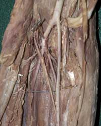 Deep Forearm Arteries