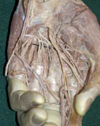 Deep Palmar Nerves and Arteries
