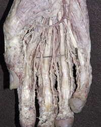 Superficial Palmar Nerves