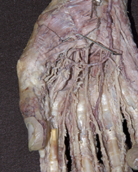 Superficial Palmar Nerves