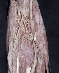 Forearm Arteries