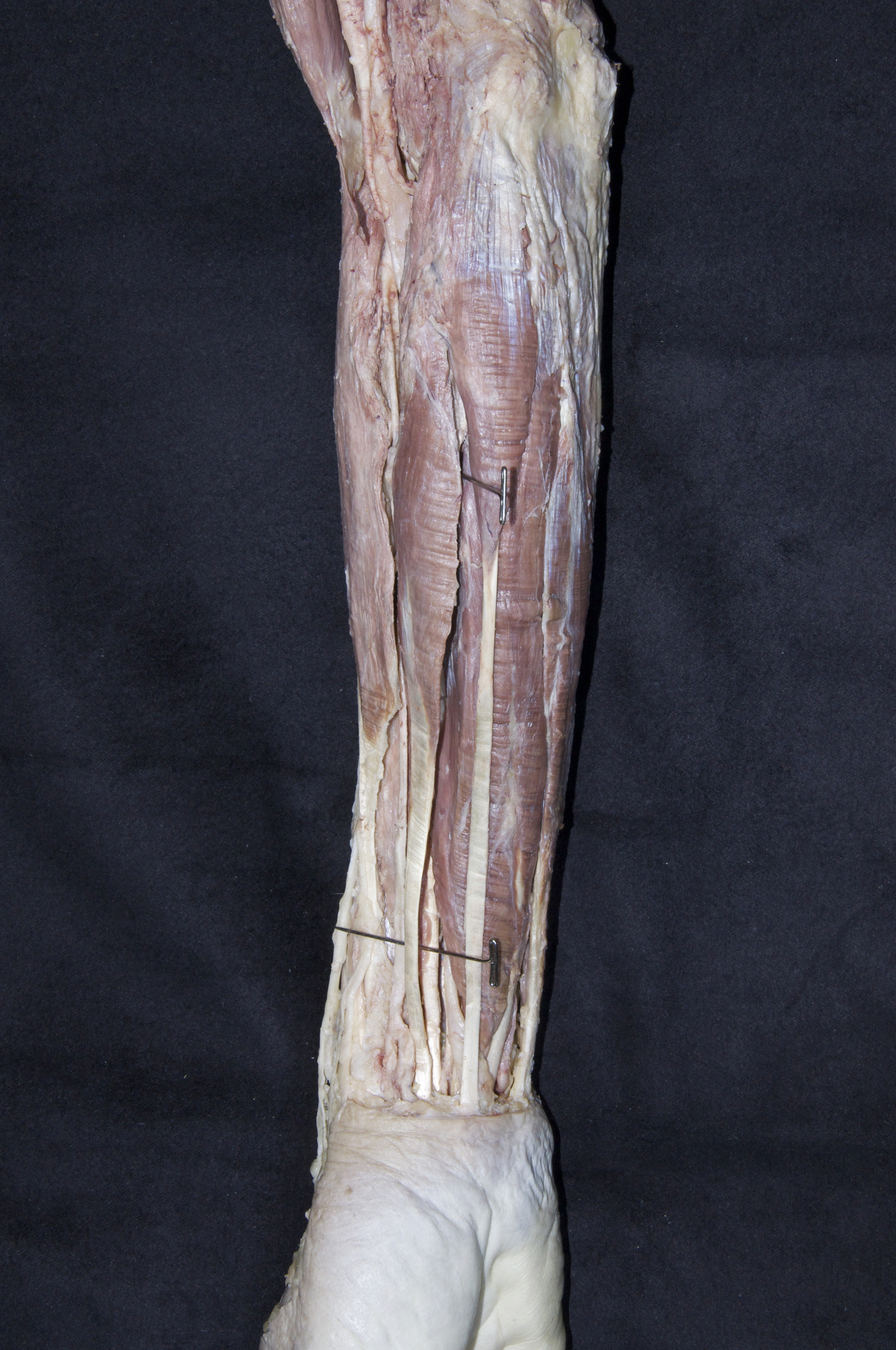 Anterior Forearm - 10